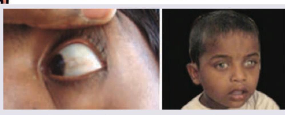 Image for question 342