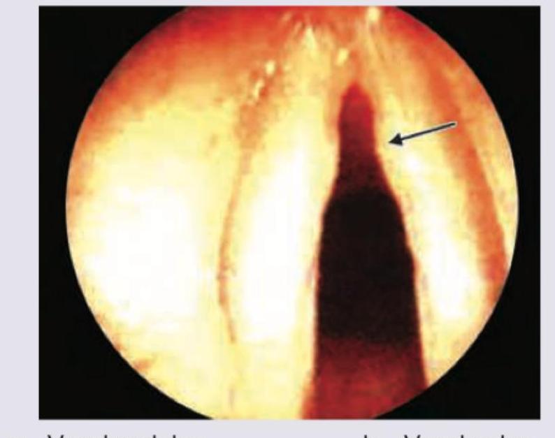 Image for question 202