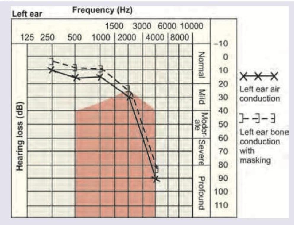 Image for question 113