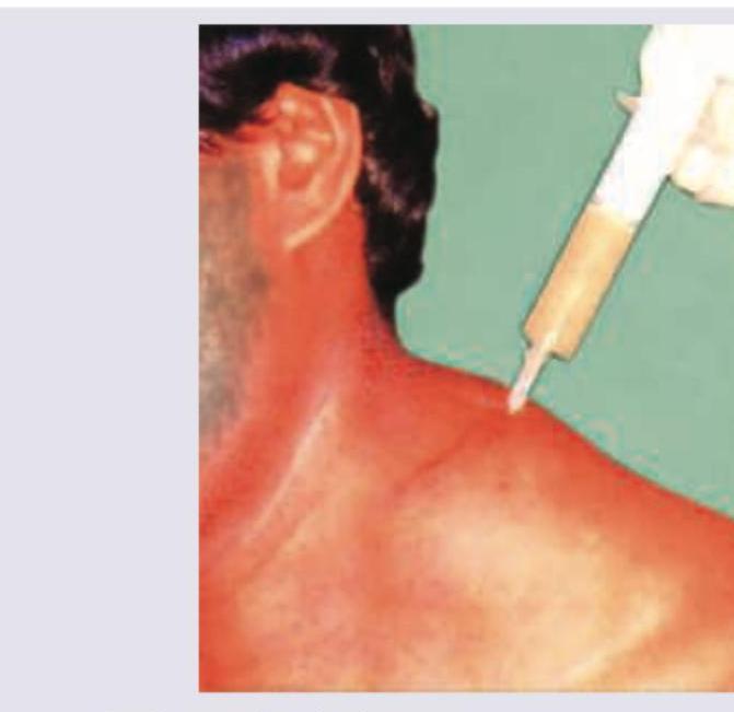 Image for question 103