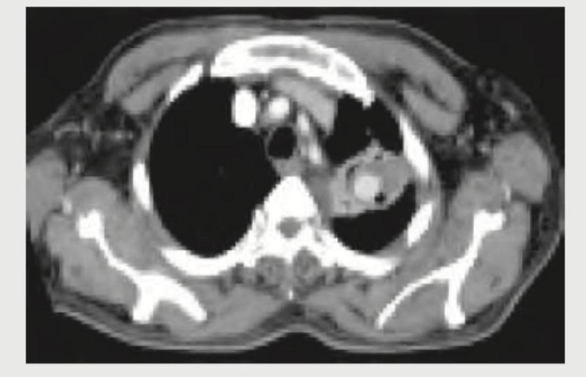 Image for question 386