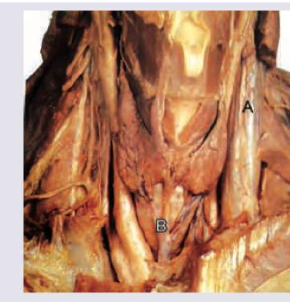 Image for question 345