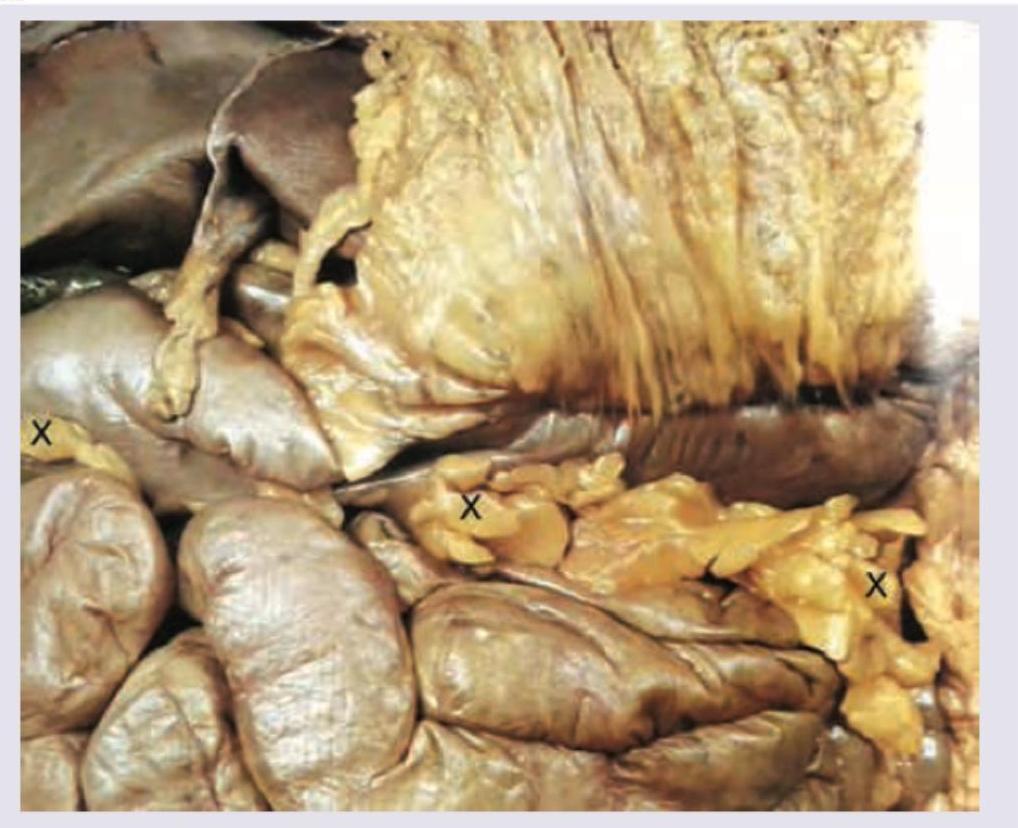 Image for question 701