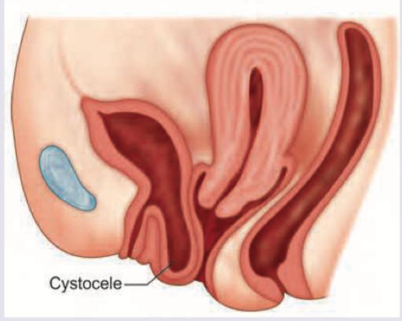 Image for question 915