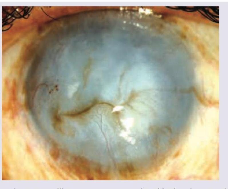 Image for question 334