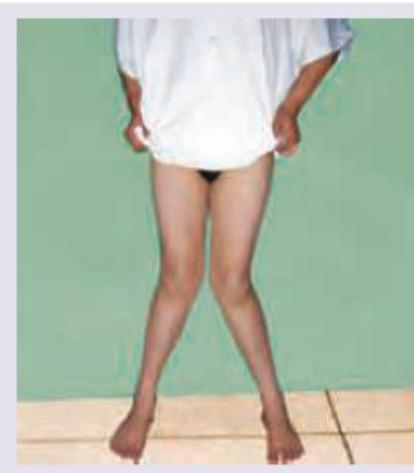 Image for question 280