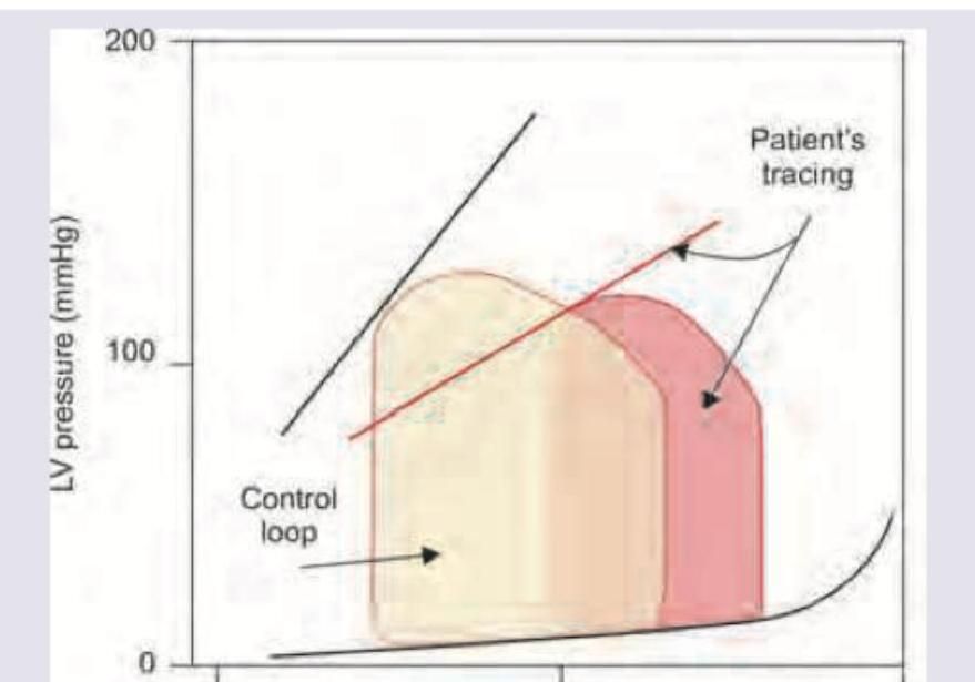 Image for question 724