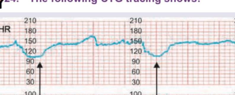 Image for question 841