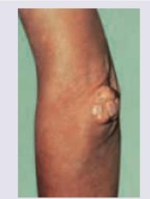 Image for question 79