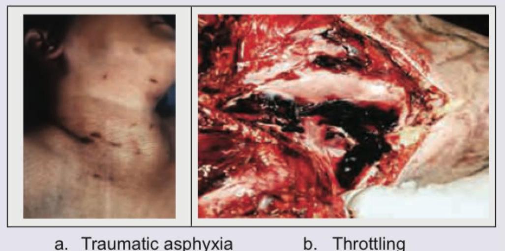 Image for question 9