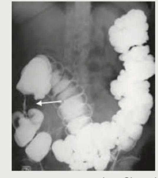 Image for question 408