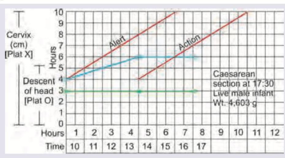 Image for question 845