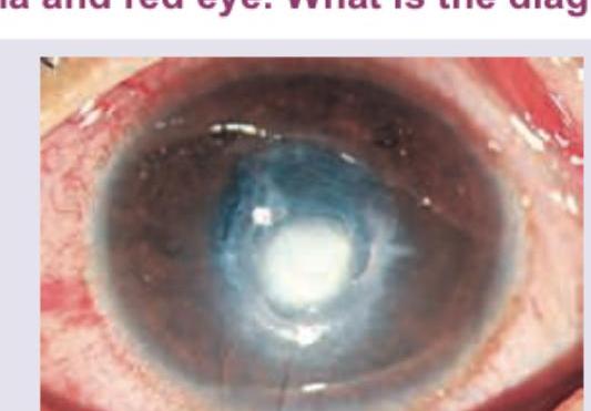 Image for question 324