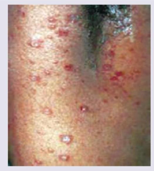 Image for question 247