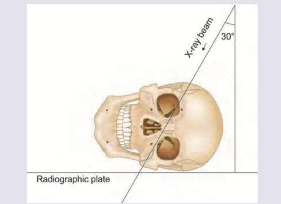 Image for question 126