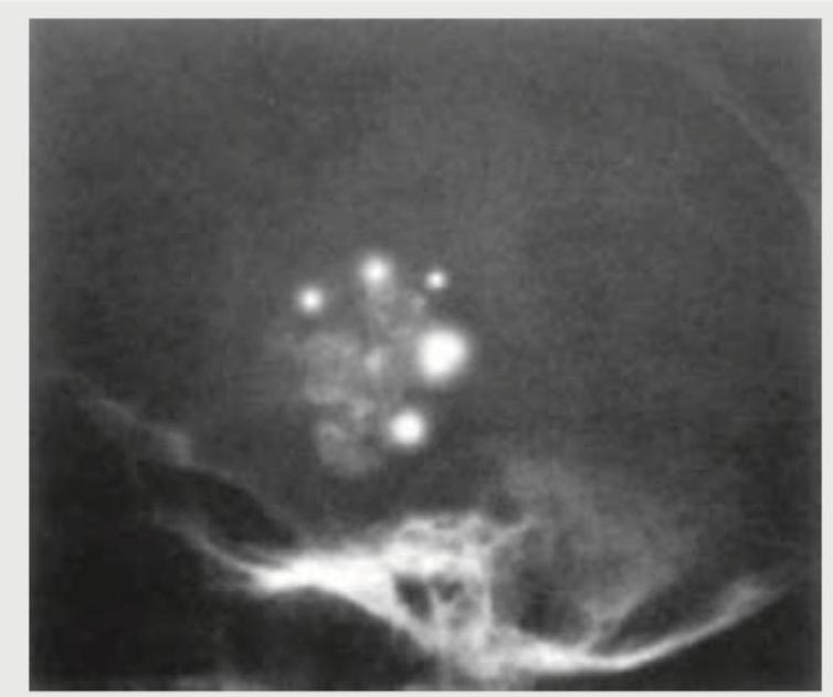 Image for question 72