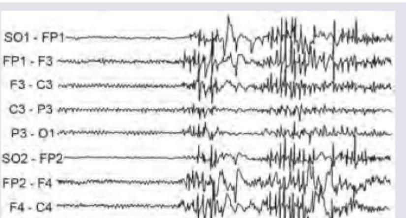 Image for question 51