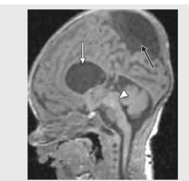 Image for question 351