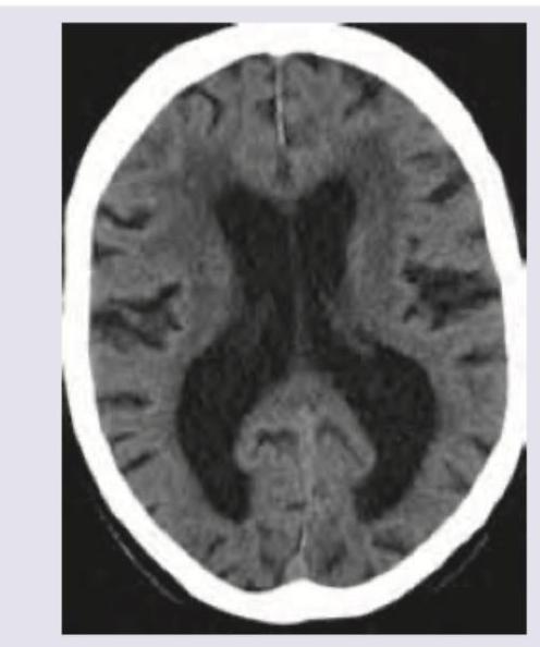 Image for question 42