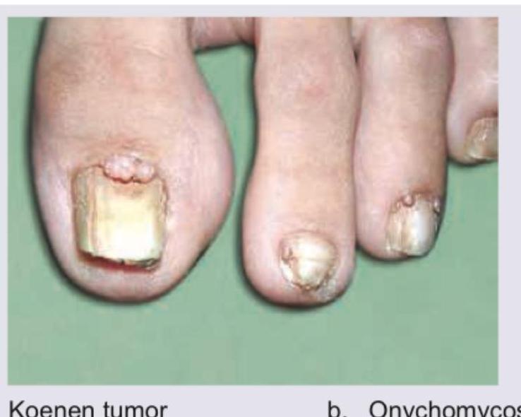 Image for question 207