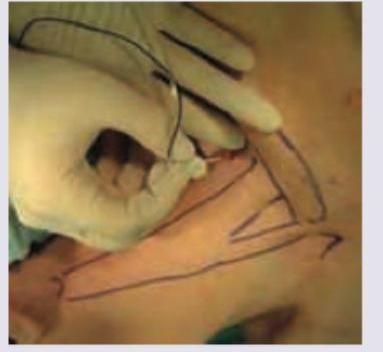 Image for question 185