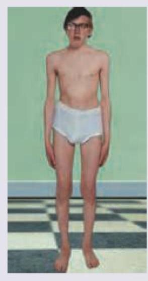 Image for question 213