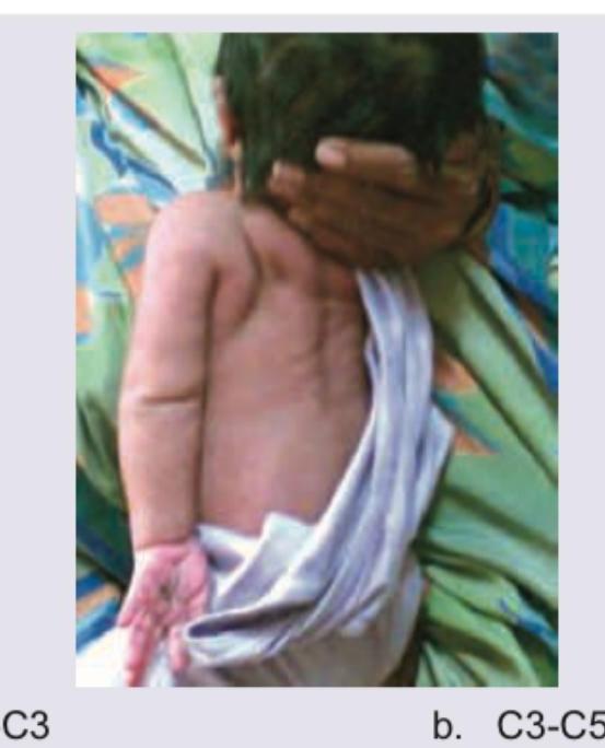 Image for question 736