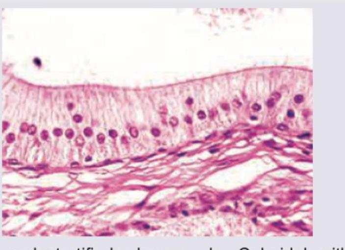 Image for question 393