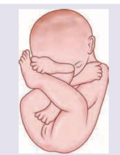 Image for question 838