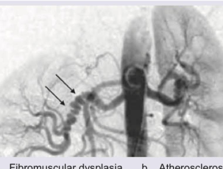 Image for question 95