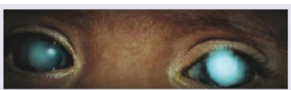 Image for question 322