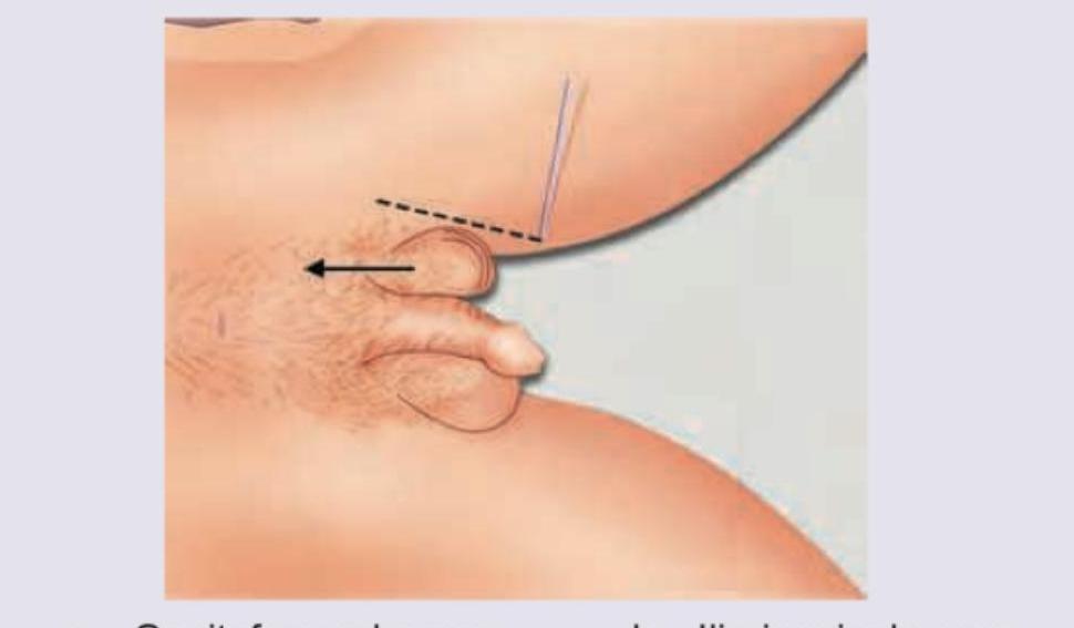 Image for question 507