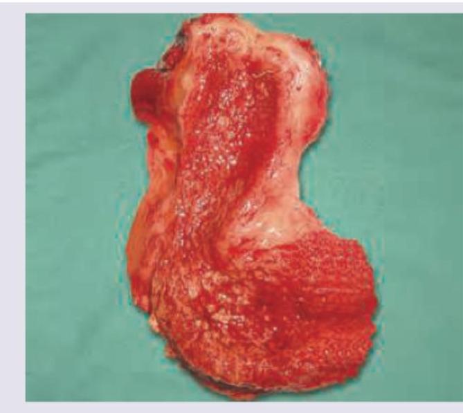 Image for question 344