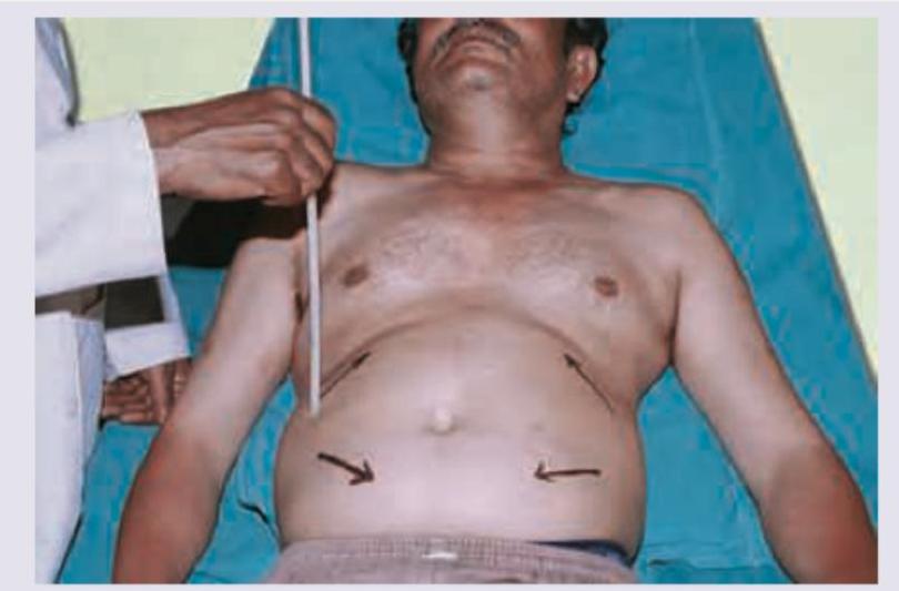 Image for question 48