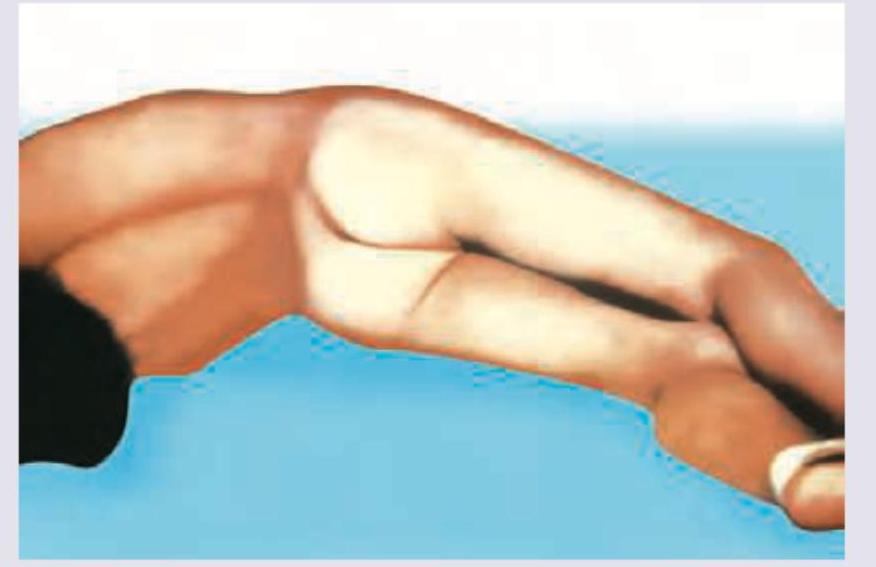 Image for question 94