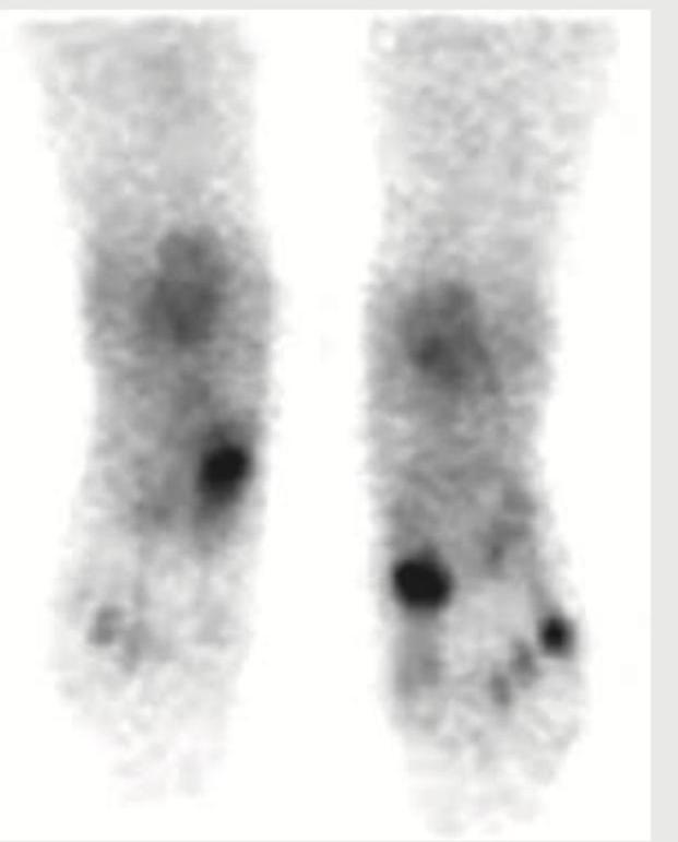 Image for question 164