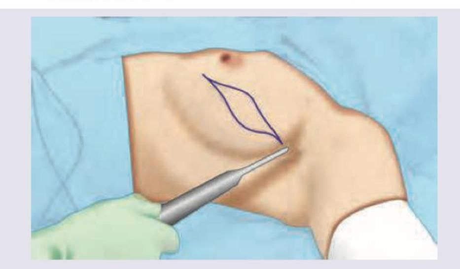 Image for question 72