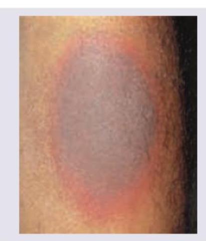 Image for question 55