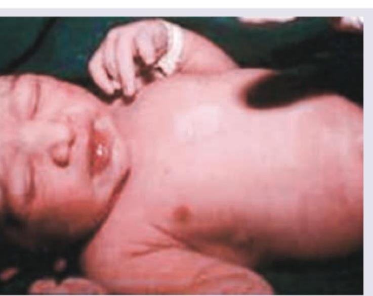 Image for question 739