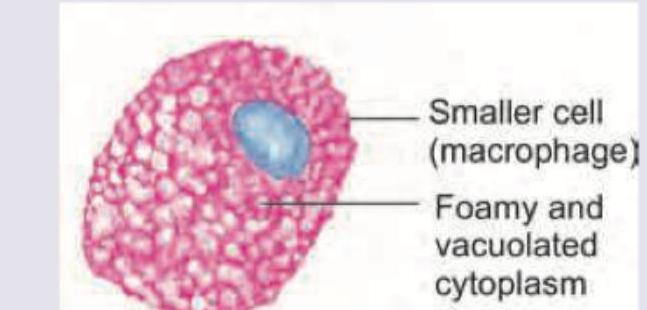 Image for question 1315
