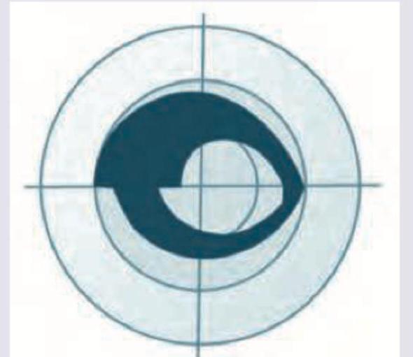 Image for question 360