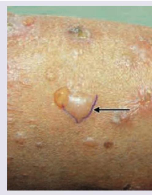 Image for question 117