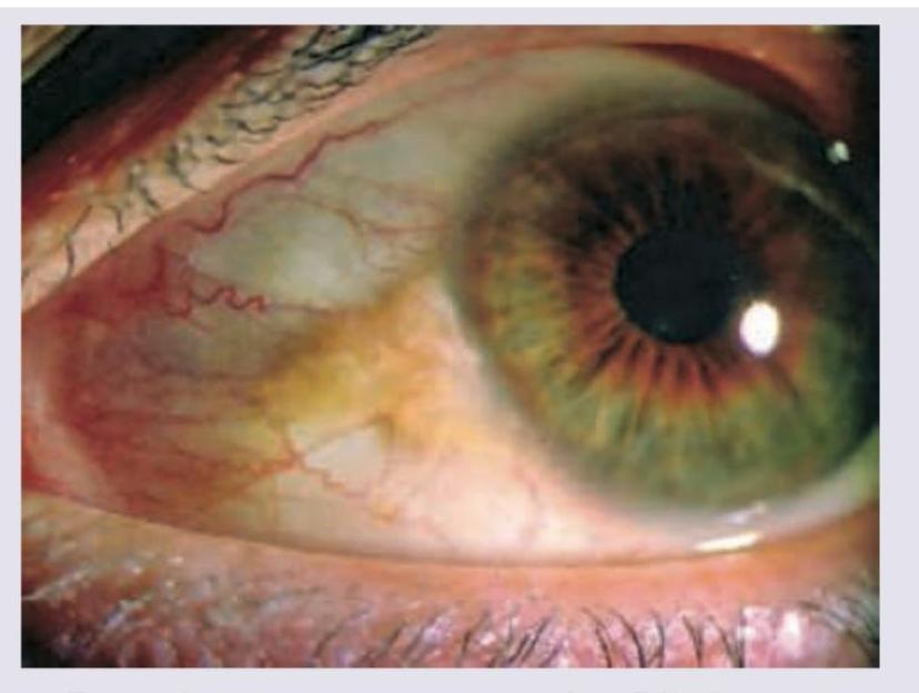 Image for question 264