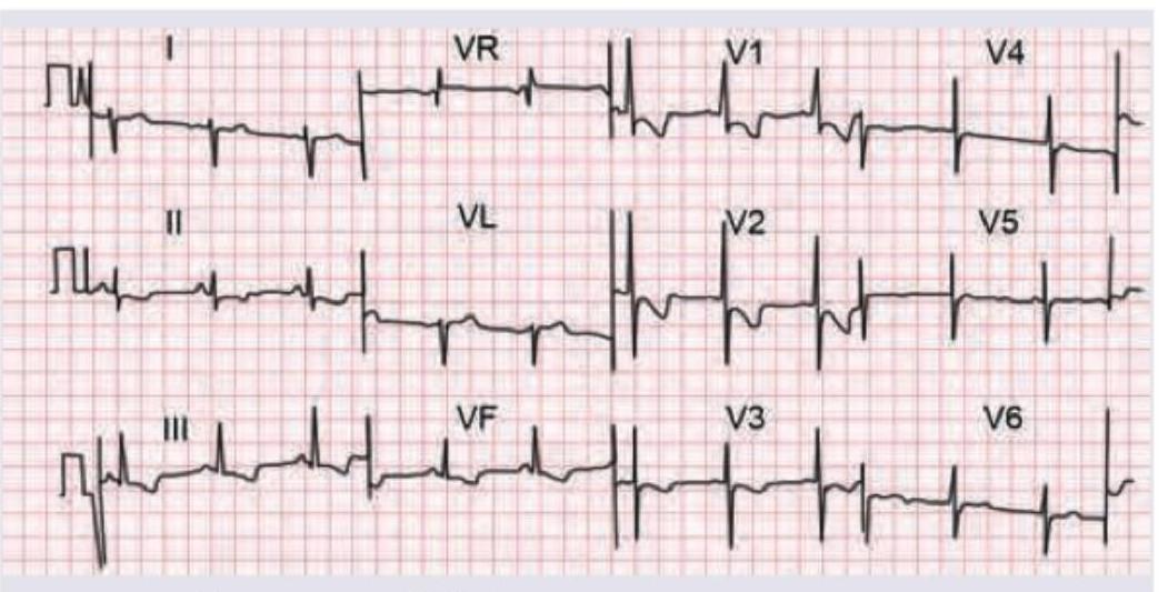 Image for question 179