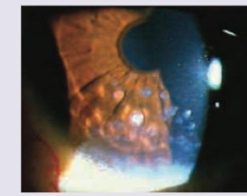 Image for question 329