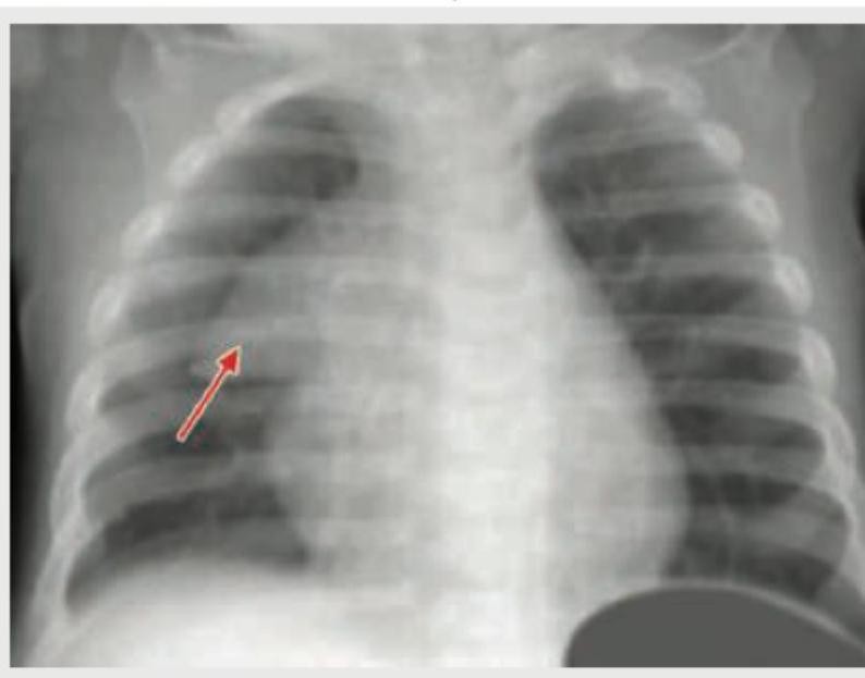 Image for question 71