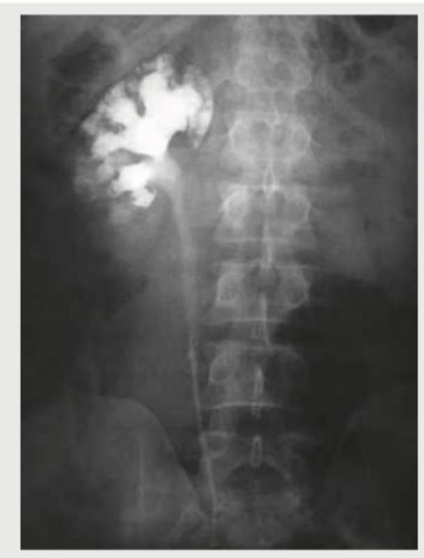 Image for question 141