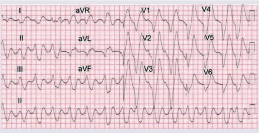 Image for question 637
