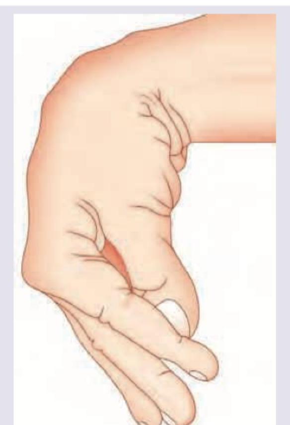 Image for question 174