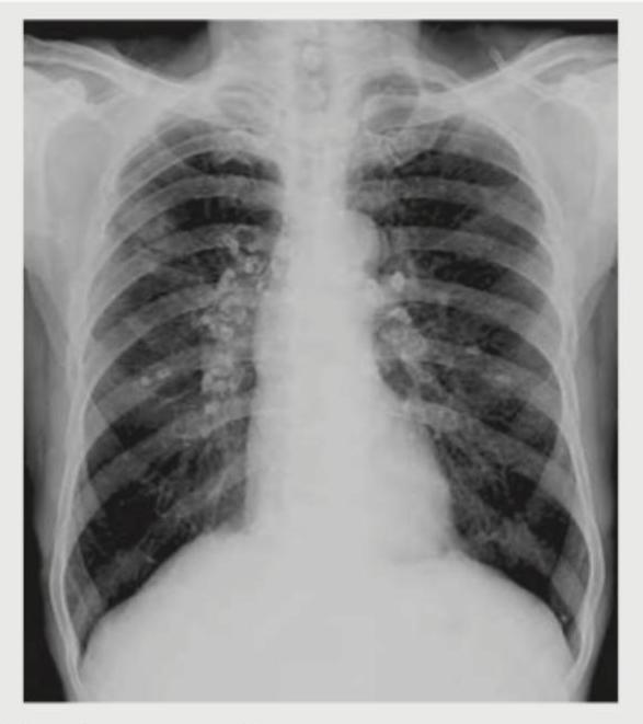 Image for question 399